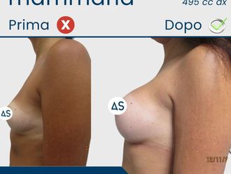 Chirurgia ricostruttiva prima e dopo - 879611