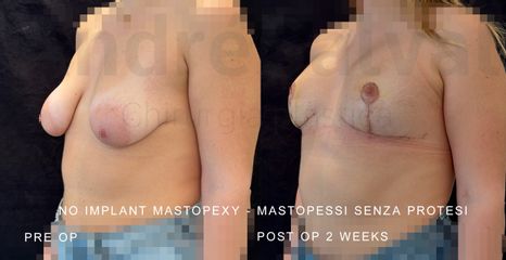 Dott. André Salval Mastopessi