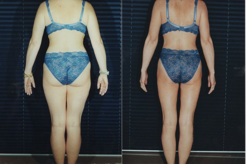 Dieta prima e dopo - 745895