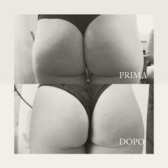 Cellulite - Dott.ssa Raffaella Lavinia Fassi