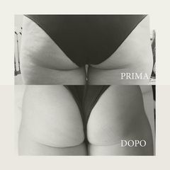 Cellulite - Dott.ssa Raffaella Lavinia Fassi