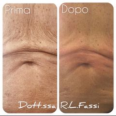 Criolipolisi - Dott.ssa Raffaella Lavinia Fassi