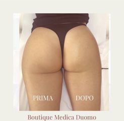 Cellulite - Dott.ssa Raffaella Lavinia Fassi