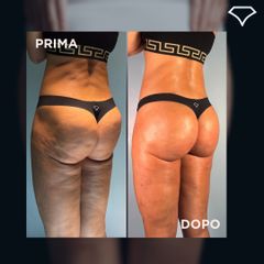 Dott. Dario Martusciello Diamond Incision