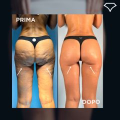 Dott. Dario Martusciello Diamond Incision