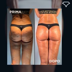 Dott. Dario Martusciello Diamond Incision