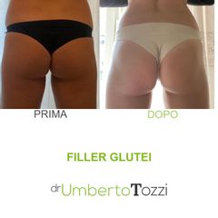 Filler glutei - Dott. Umberto Tozzi - Clinique Visage