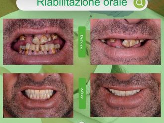Ortodonzia - 850090