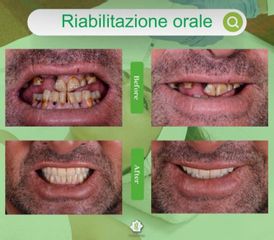 Ortodonzia - Dott. Umberto Tozzi - Clinique Visage