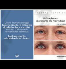 Dott. Giorgio Berna Blefaroplastica