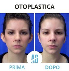 Otoplastica - Dott. Orlandi Alberto