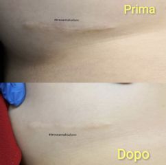Cicatrici - Dott.ssa Annalisa Forni Medical Center