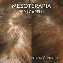 Mesoterapia per i capelli - Dott. Emanuele Chittano Congedo