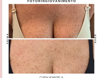 Laserterapia - 310024