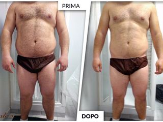 Dimagrimento prima dopo 