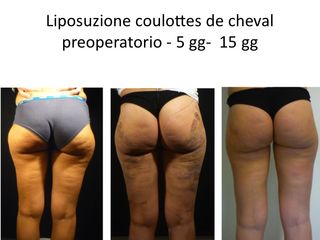 Llipo coulottes de chaval