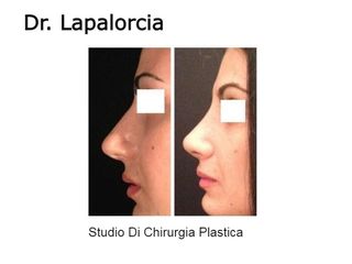 Dr. Lapalorcia, Studio Di Chirurgia Plastica