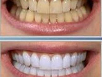 Dentisti-744039