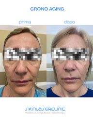 Skin Laser Clinic Aging del volto