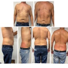 Dieta - Lasermed Srl