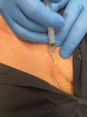 Biorivitalizzazzione - Studio Medico Brenno Franceschini