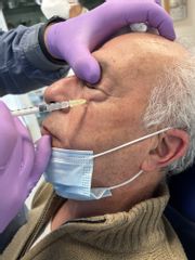 Mesoterapia per ridurre le occhiaie di grasso, Studio Medico Brenno Franceschini