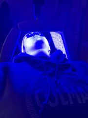 Terapia della luce per Acne,capillari, rosacea, antiage