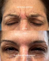 Studio Medico Brenno Franceschini Botox