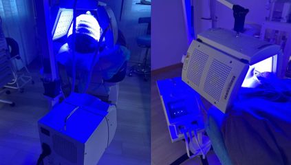 Studio Medico Brenno Franceschini Lampada UV antiagi aging