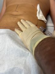 Studio Medico Brenno Franceschini Intralipoterapia