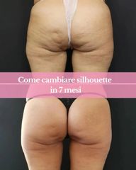 Dott.ssa Irene Pistis rimodellare il corpo