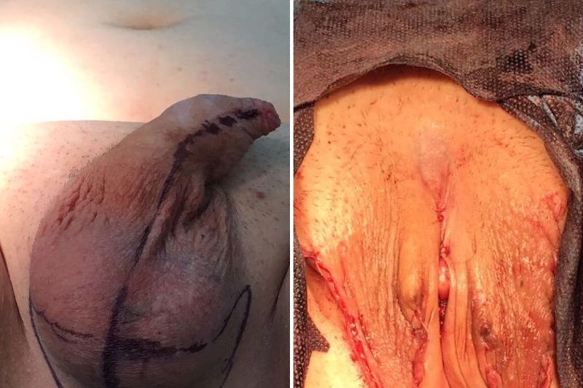 Cambio di sesso prima e dopo - 767563
