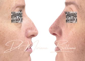 Dr. Miriana Bellomo Rinofiller