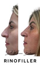 Dr. Miriana Bellomo Rinofiller