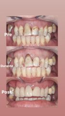 Dott.ssa Miriana Bellomo Ricostruzione estetiche in composito