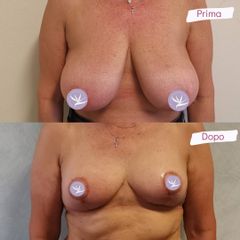 Mastopessi - Dott. Licata Giovanni