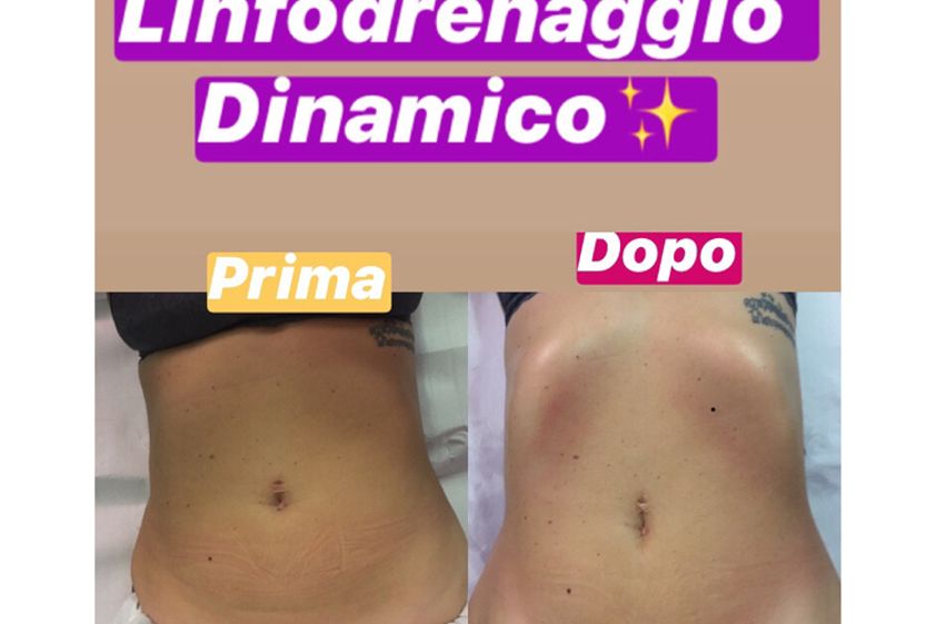 Linfodrenaggio prima e dopo - 769654