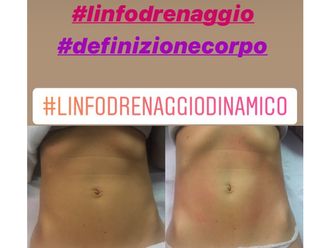 Linfodrenaggio prima e dopo - 769657