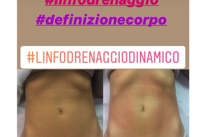 Linfodrenaggio prima e dopo - 769657