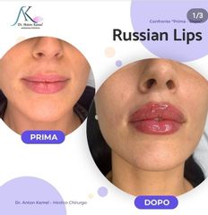 Russian Lips - Poliambulatorio Med360