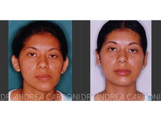 Chirurgia Maxillo facciale - 771335