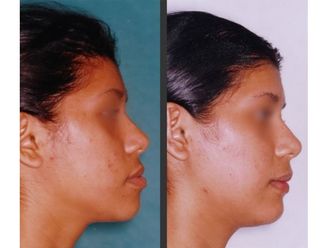 Chirurgia Maxillo facciale-791046