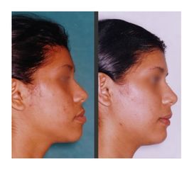 Chirurgia Maxillo facciale - Studio Medico Dr Andrea Carboni