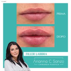 Dott.ssa Arianna C. Sanzo Filler Labbra