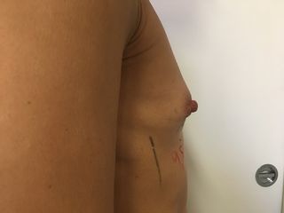 Situazione preoperatoria