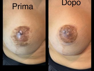 Chirurgia ricostruttiva prima e dopo - 870576