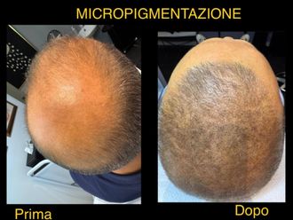 Microblading prima e dopo - 876749