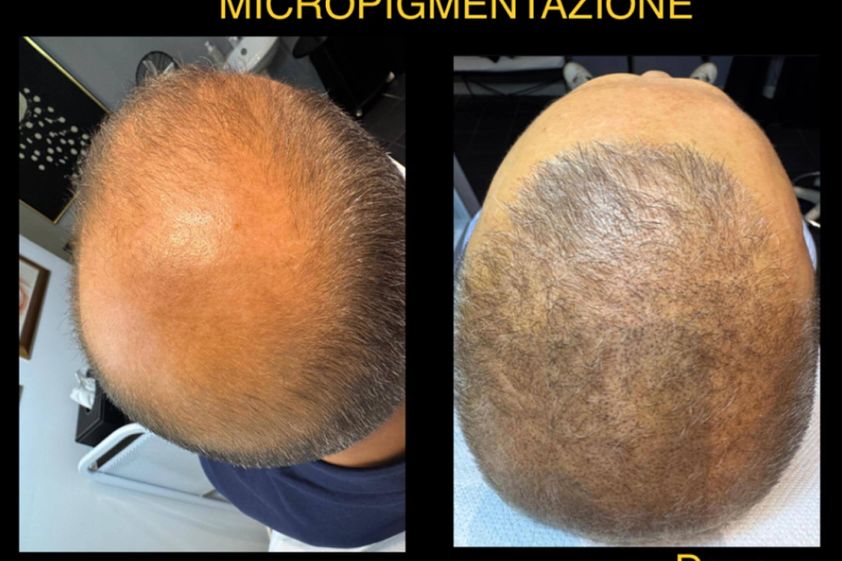 Microblading prima e dopo - 876749