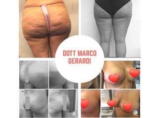 Dott Marco Gerardi