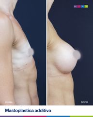 Dott. Ugo & Aldo Majani - MIAS Medical Center Mastoplastica Additiva